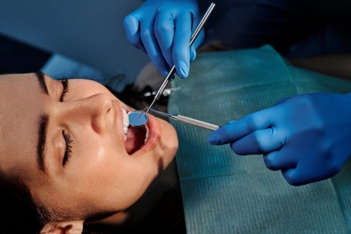 prestation Facettes dentaires Cannes