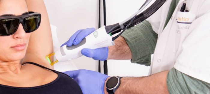 prestation Épilation laser des aisselles Cannes