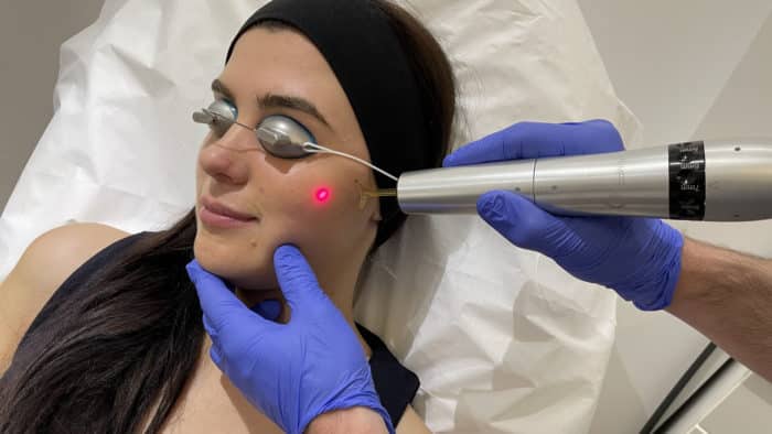 prestation Skin Tightening laser Cannes 