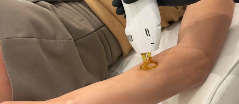 Épilation laser : comment fonctionne le traitement ? | All Aesthetics