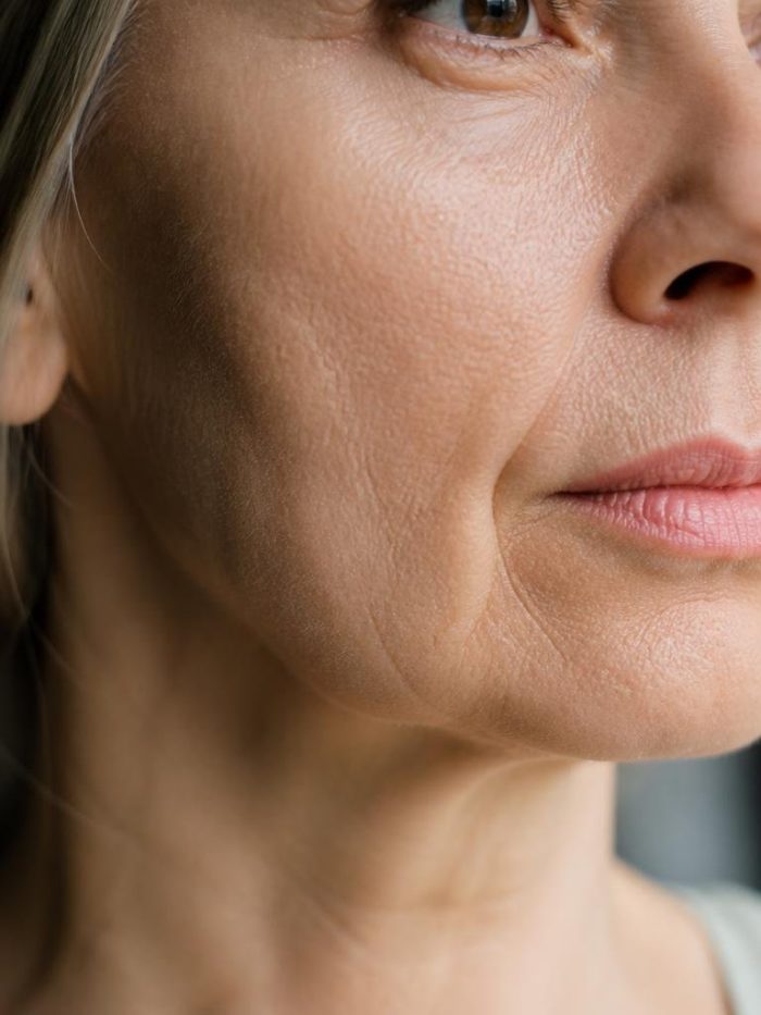 collagene diminue avec