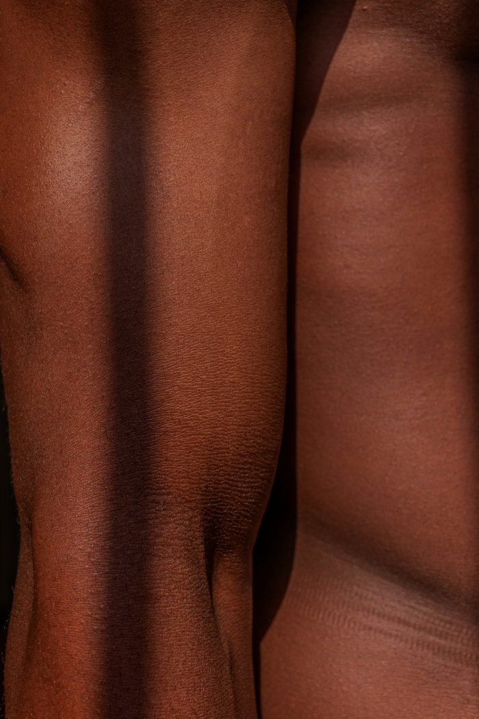 Epilation peau mate - Centre esthétique - All Aesthetics Cannes