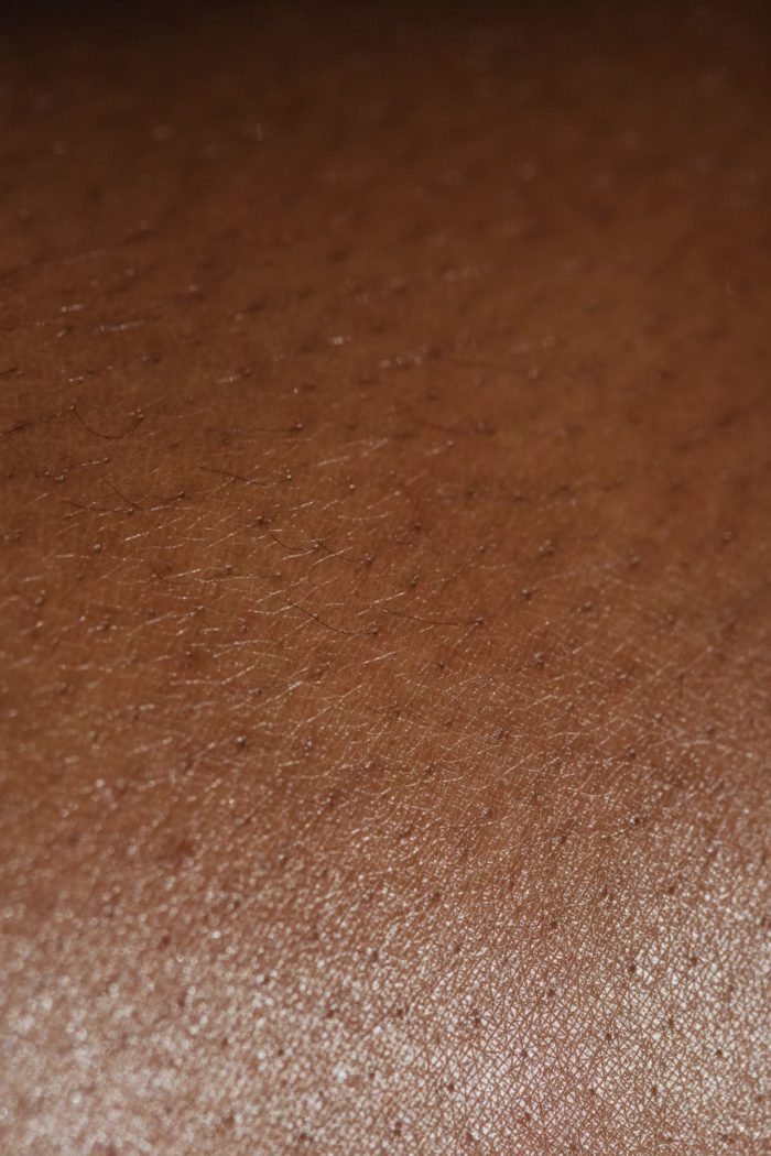 Epilation peau mate - Centre esthétique - All Aesthetics Cannes